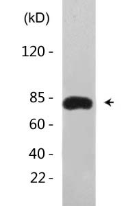 Ub (Acetyl Lys29) Polyclonal Antibody