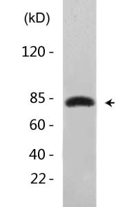 Ub (Acetyl Lys33) Polyclonal Antibody