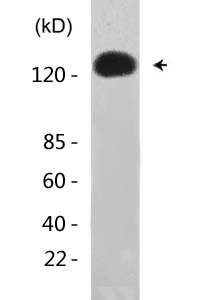 CRM1 (Acetyl Lys568) Polyclonal Antibody