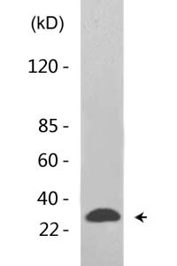 14-3-3-pan (Acetyl Lys51/49) Polyclonal Antibody