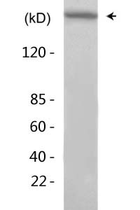 p300 (Acetyl Lys1542) Polyclonal Antibody