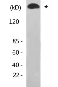 p300 (Acetyl Lys1558/Acetyl Lys1560) Polyclonal Antibody