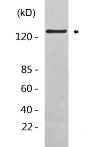 RIP140 (Acetyl Lys158) Polyclonal Antibody