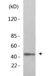 TAL1/2 (Acetyl Lys221/Acetyl Lys222/Acetyl Lys36/Acetyl Lys37) Polyclonal Antibody