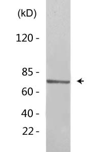 Tau (Acetyl Lys686) Polyclonal Antibody