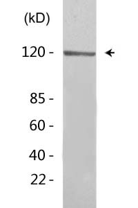 Acetyl-EPAS-1 (K385) Polyclonal Antibody