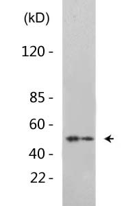 E2F-1 (Acetyl-Lys120) Polyclonal Antibody