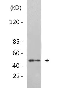 GATA-2/3 (Acetyl-Lys336/304) Polyclonal Antibody