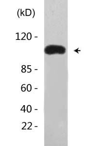 AR (Acetyl Lys633) Polyclonal Antibody