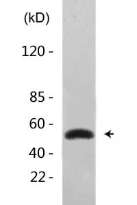 FoxO4 (Acetyl Lys189) Polyclonal Antibody