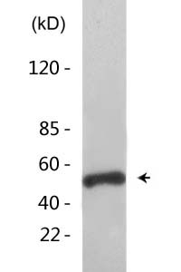 HNF-4α/γ (Acetyl Lys127/79) Polyclonal Antibody