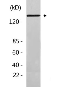 PDGFR-β (phospho Tyr1021) Polyclonal Antibody