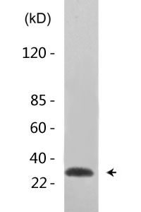 IGFBP3 (phospho Ser183) Polyclonal Antibody