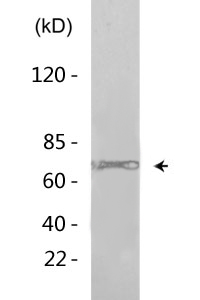 Emt (phospho Tyr512) Polyclonal Antibody