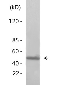 Presenilin 2 (phospho Ser330) Polyclonal Antibody