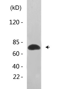 LIMK-2 (phospho Ser283) Polyclonal Antibody