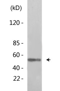 Akt (phospho Tyr315) Polyclonal Antibody