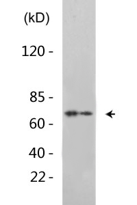 p70 S6 kinase α (phospho Ser427) Polyclonal Antibody