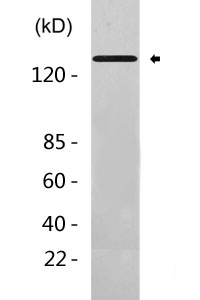 PERK (phospho Thr981) Polyclonal Antibody