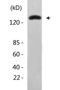 Flt-1 (phospho Tyr1048) Polyclonal Antibody