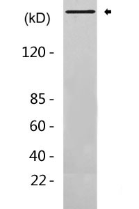 IP3R-I (phospho Ser1764) Polyclonal Antibody