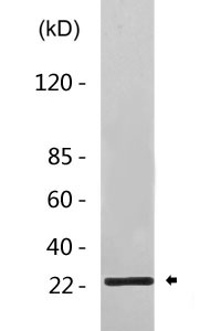 TIRAP (phospho Tyr86) Polyclonal Antibody