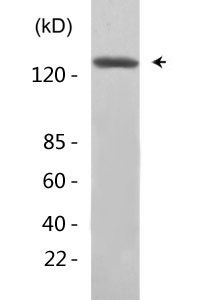 Tuberin (phospho Tyr1571) Polyclonal Antibody