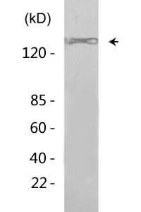 TBC1D4 (phospho Thr642) Polyclonal Antibody