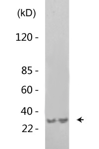 HSF1 (phospho Ser307) Polyclonal Antibody