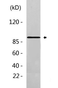 MLK3 (phospho Ser674) Polyclonal Antibody