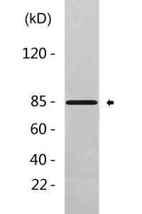 Catenin-β (phospho Ser552) Polyclonal Antibody