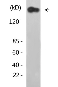 Atm (phospho Ser1981) Polyclonal Antibody