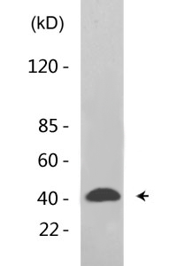 MDM2 (Phospho-Tyr394) Antibody