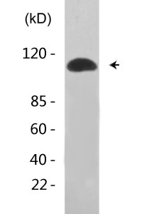 Sodium Potassium ATPase alpha-1 (Phospho-Tyr260) Antibody