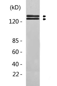 JAK2/3 (Phospho-Tyr966/939) Antibody