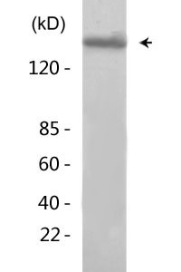 IGF1R (Phospho-Tyr1161) Antibody