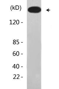 mTOR (Phospho-Ser2448) Antibody