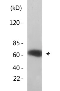 RIPK2 (Phospho-Ser176) Antibody