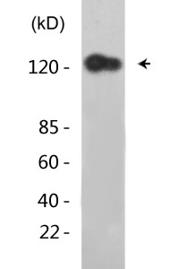 DDR1 (Phospho-Tyr513) Antibody