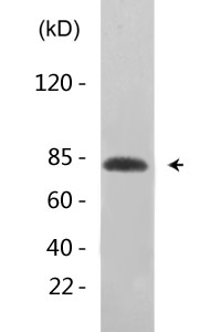 GRK2 (Phospho-Ser685) Antibody