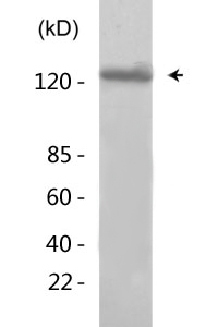 Abl1/2 (phospho Tyr393/439) Polyclonal Antibody