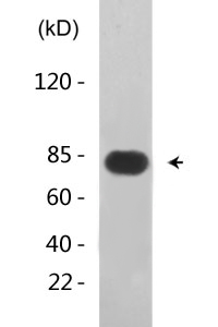 Adducin α/β (phospho Ser726/713) Polyclonal Antibody