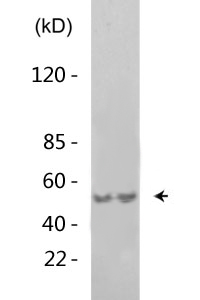 Akt (phospho Thr308) Polyclonal Antibody