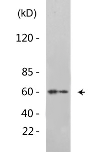 Akt (phospho Thr308) Polyclonal Antibody