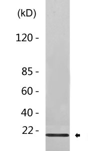 Bad (phospho Ser155) Polyclonal Antibody