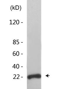 Bcl-2 (phospho Ser70) Polyclonal Antibody