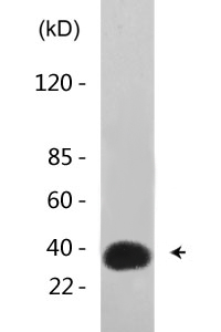 CKR-5 (phospho Ser336) Polyclonal Antibody