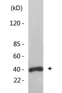 CKR-5 (phospho Ser349) Polyclonal Antibody