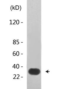 Cdk2/Cdc2 (phospho Thr160) Polyclonal Antibody