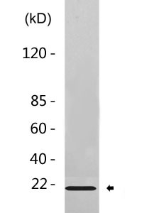 p21 (phospho Thr145) Polyclonal Antibody